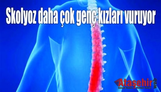 SKOLYOZ DAHA ÇOK GENÇ KIZLARI VURUYOR