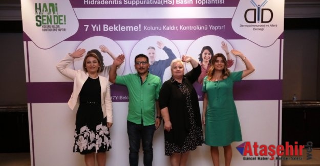 7 Yıl Bekleme! Kolunu Kaldır, Kontrolünü Yaptır