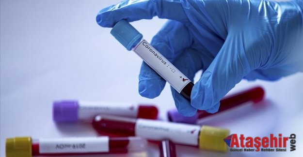 Test yaparak öğrenebilirsiniz