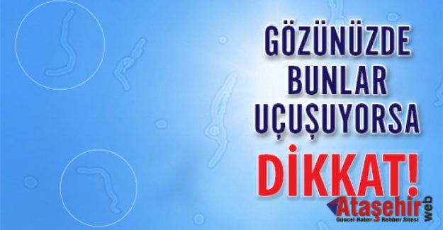 GÖRME ALANINIZDA SİNEKLER UÇUŞUYORSA