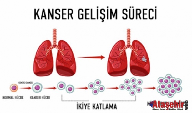 4. Evre Kanserde Tedavi Seçenekleri ve Umut