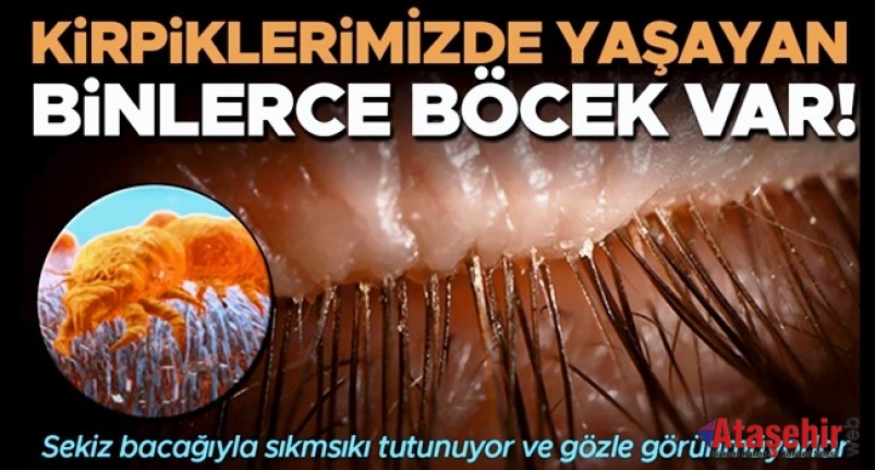 Kirpiklerinizde Yaşayan Mikroskobik Akarlar