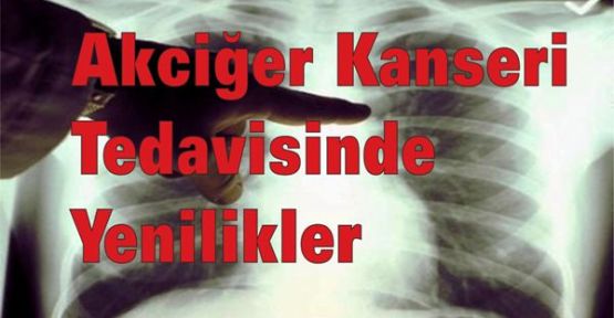 Akciğer Kanseri Tedavisinde Yenilikler