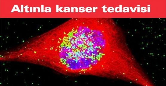 Altınla kanser tedavisi yapılacak