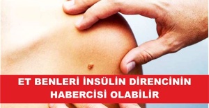 ET BENLERİ İNSÜLİN DİRENCİNİN HABERCİSİ OLABİLİR