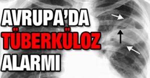 Avrupa’da verem alarmı