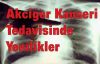 Akciğer Kanseri Tedavisinde Yenilikler