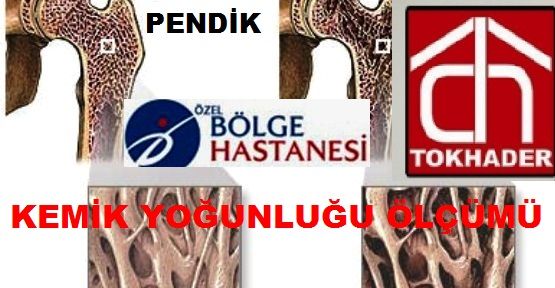 TOKHADER, YENİSAHRA’da KADINLARA ÜCRETSİZ KEMİK ÖLÇÜMÜ