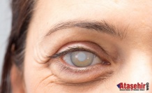 Kök Hücre Tedavisi ile Tavuk Karası Hastalığında Umut Verici Gelişme