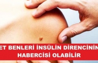 ET BENLERİ İNSÜLİN DİRENCİNİN HABERCİSİ OLABİLİR
