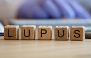 Yüzünüzdeki Lekeler Lupus Belirtisi Olabilir 