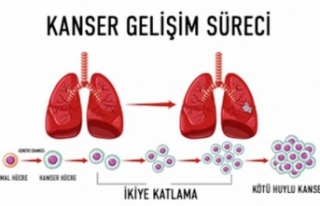 4. Evre Kanserde Tedavi Seçenekleri ve Umut