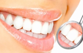 Diş beyazlatmada doğru bilinen yanlışlar!