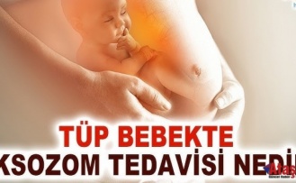 Tüp bebekte destek yöntem: eksozom tedavisi