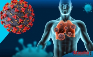 Yeni H3N2 Virüsü Kuzey Yarımkürede Yayılıyor