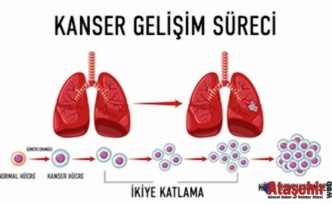 4. Evre Kanserde Tedavi Seçenekleri ve Umut