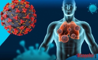 Yeni H3N2 Virüsü Kuzey Yarımkürede Yayılıyor