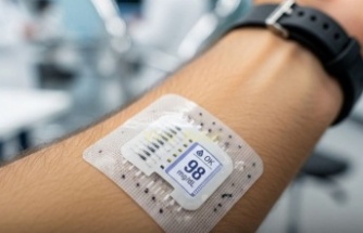 Samsung’un Kan Şekeri Takip Teknolojisi