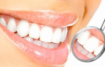 Diş beyazlatmada doğru bilinen yanlışlar!