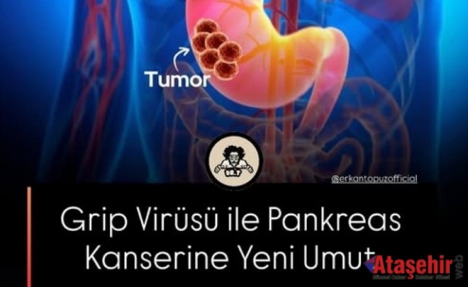 Pankreas Kanserine Yeni Umut
