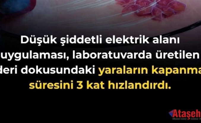 Elektrik Alanları Yara İyileşmesini Üç Kat Hızlandırabilir