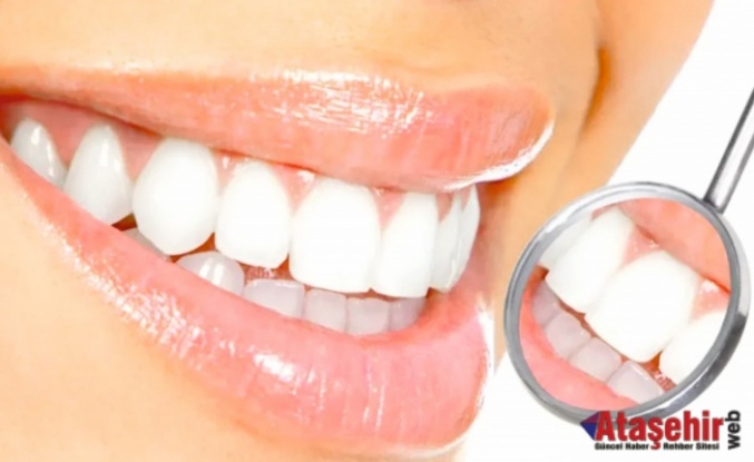 Diş beyazlatmada doğru bilinen yanlışlar!