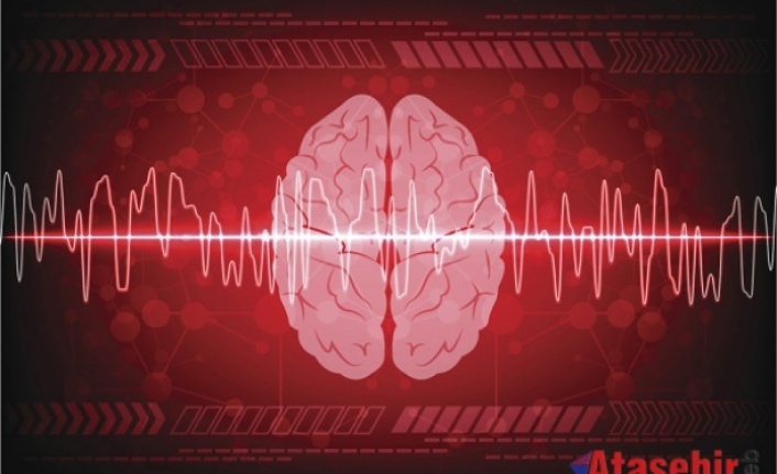 Ölüm anında beyin aktivitesi ilk kez görüntülendi: