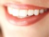 Dişhekimi Korkusu (dentafobi) (dişçi korkusu)