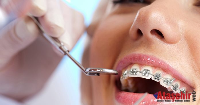 Ortodontik Tedavi Her Yaşta Uygulanabilir Mi?