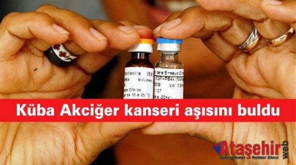 Küba Akciğer kanseri aşısını buldu