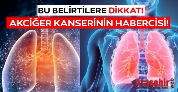 Akciğer Kanserinin 4 Önemli Öncül Belirtisi