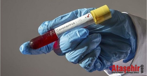 İstanbul'da Evde koronavirüs testi İstanbul'da başladı