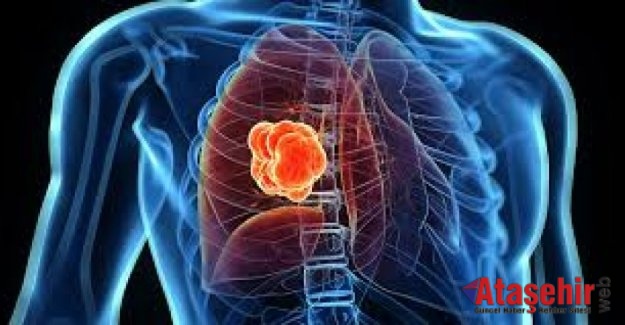 Akciğer kanserinde ölüm oranları giderek azalıyor
