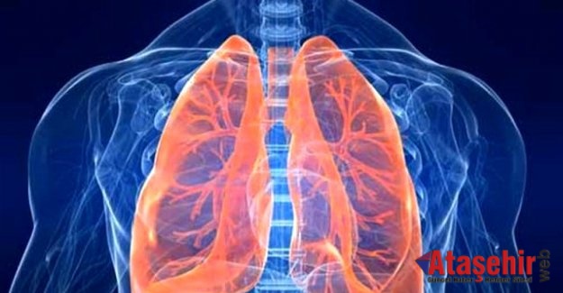 Akciğer Kanserinin Yan Etkilerine ‘Pulmoner Rehabilitasyon’