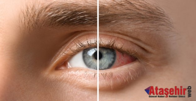Diyabet hangi göz hastalıklarına yol açar?