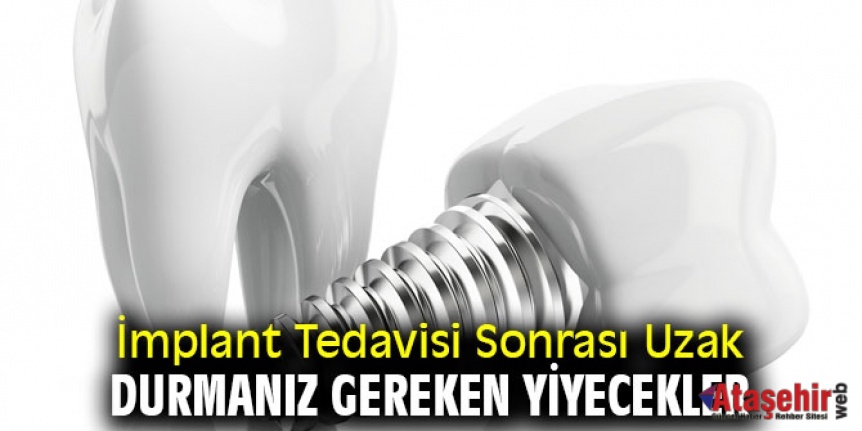 İmplant Tedavisi Sonrası Uzak Durmanız Gereken Yiyecekler