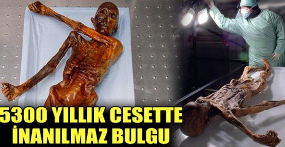 5300 yıllık ceset 'Otzi'de inanılmaz bulgu