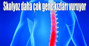 SKOLYOZ DAHA ÇOK GENÇ KIZLARI VURUYOR