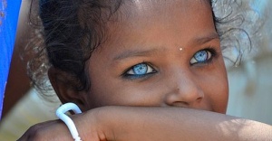 Mavi gözlü Afrikalılar