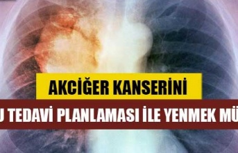 AKCİĞER KANSERİNİ DOĞRU TEDAVİ PLANLAMASI İLE YENMEK MÜMKÜN