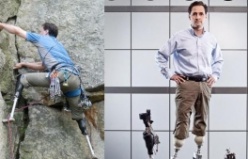 Biyonik Bacak Teknolojisinde Gelinen Son Nokta, New bionics let us run, climb and dance | Hugh Herr