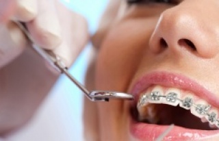 Ortodontik Tedavi Her Yaşta Uygulanabilir Mi?