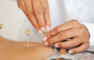 Akupunktur tek başına zayıflatmaz