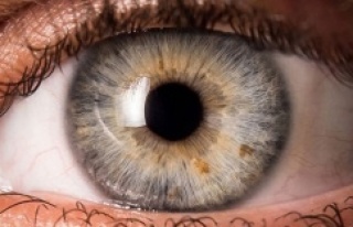 Göz tansiyonu nedir, nasıl tedavi edilir?