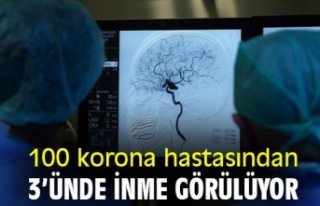 Her 100 korona hastasından 3’ünde inme görülüyor