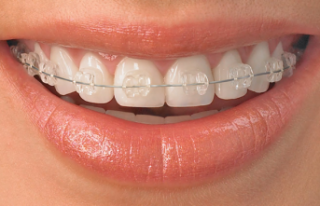 Estetik Diş Hekimliğinde Ortodonti