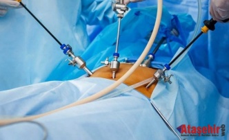 Laparoskopik kalp ameliyatı nedir?