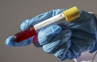 Kuzey Kıbrıs'ta bir aydır koronavirüs vakası görülmedi