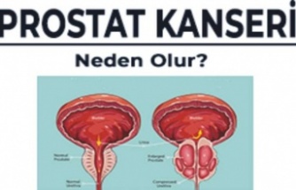 Prostat kanseri nedir?