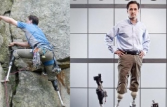 Biyonik Bacak Teknolojisinde Gelinen Son Nokta, New bionics let us run, climb and dance | Hugh Herr